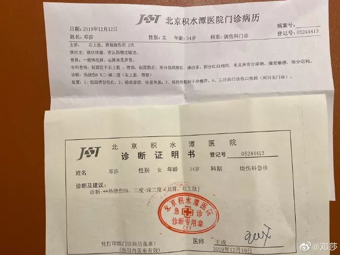 诊断书上写到,烧伤8%,二度