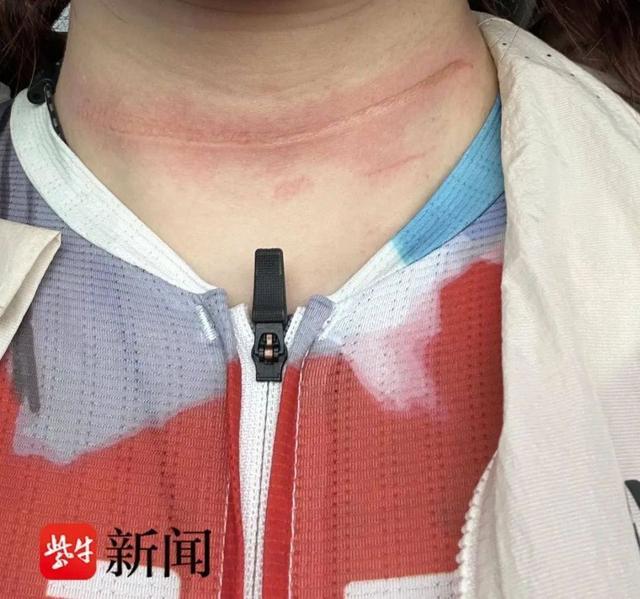 女生在骑行比赛被风筝线“割喉”承办单位称已签免责beat365app协议(图1)