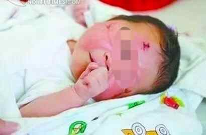 由于赔偿，Xiamen车祸叛乱的Miracle Baby Baby Kaba