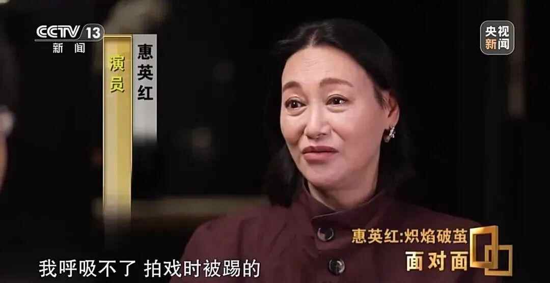 65岁的Hui Yinghong宣布，他的脸上有89针，他的鼻子