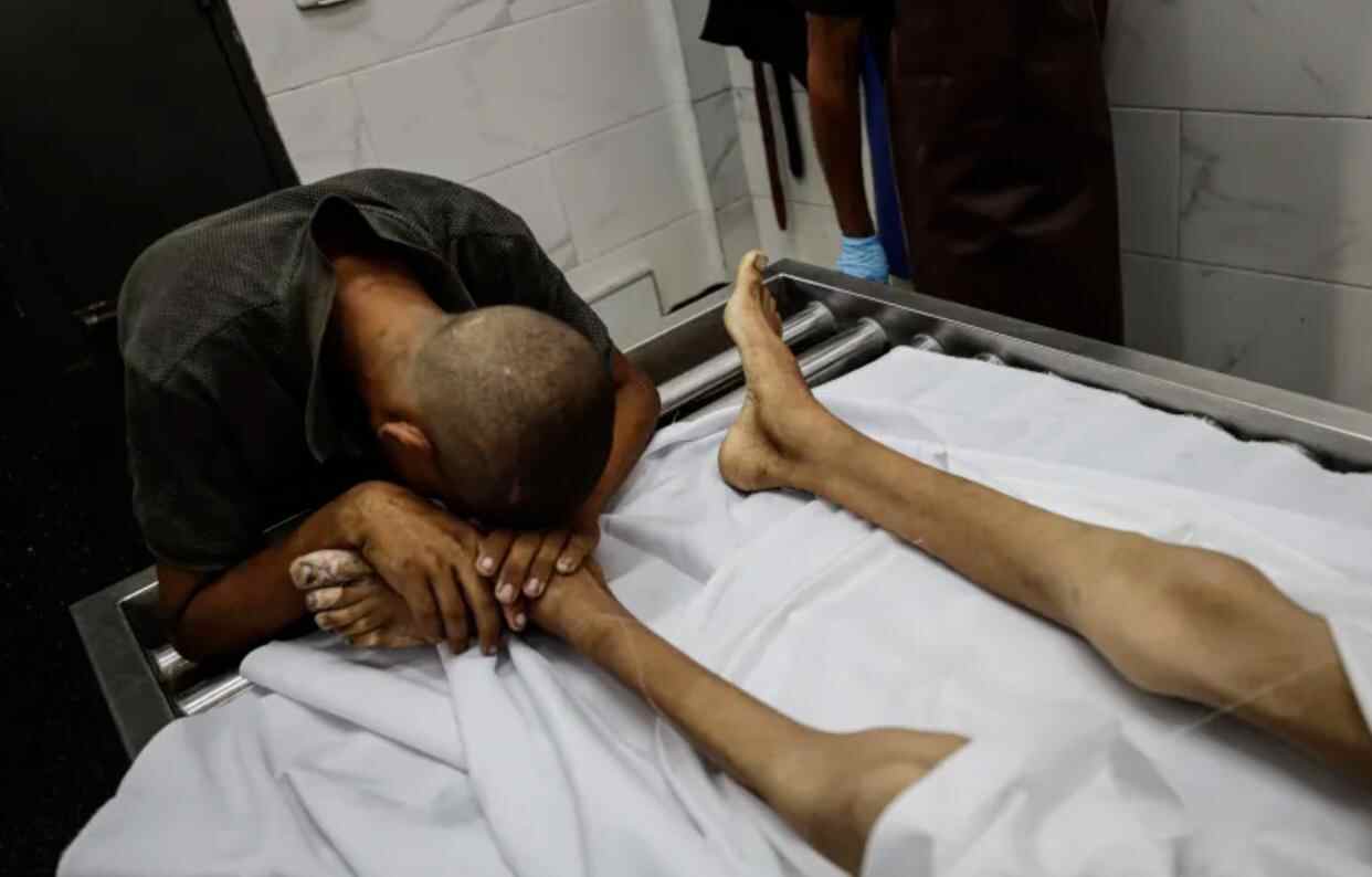 一个17岁的加沙男孩饿死了，曾经是健康的运动冠