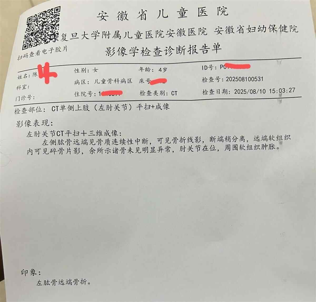 一个4年的女孩在玩车轮时被骨折的手损坏。一些