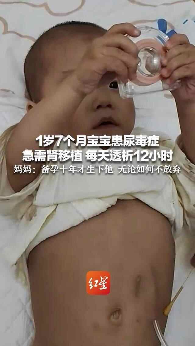 一个年龄和七个月的婴儿患有尿尿症，立即需要