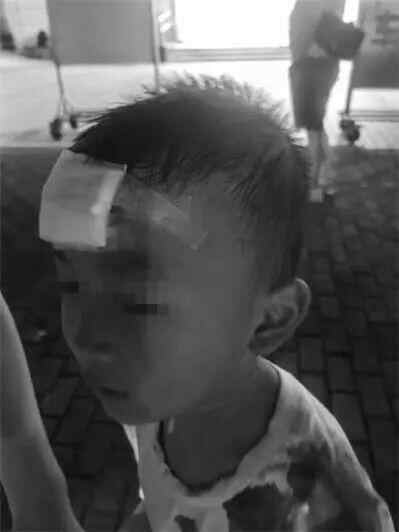 血液继续流动，脸上缝了30针，需要整形手术！谁