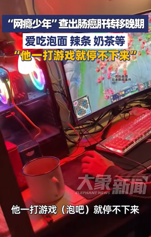 一名19岁“网瘾少年”被诊断出肠癌晚期肝转移。