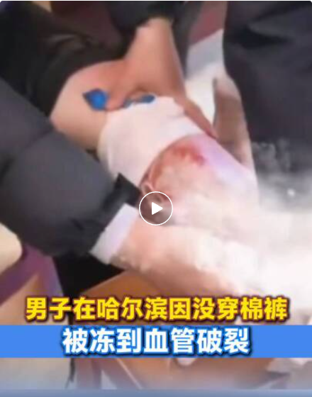 男子在哈尔滨没穿棉裤被冻到血管破裂！女警边救助边嘱咐：在东北，出门你就得穿上棉裤-上淘有品虚拟资源下载